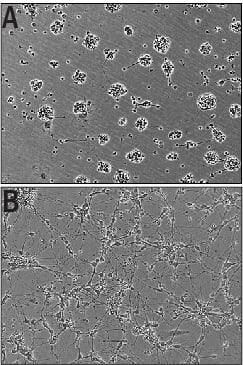 Recombinant Human IGSF4C/SynCAM4Fc Chimera (Catalog # 9905-S4) Induces Cortical Neurite Outgrowth.A) Untreated E16-18 embryonic rat cortical neurons. B) Neurite outgrowth inE16-18 embryonic rat cortical neurons treated with 0.5 μg/mL ofRecombinant Human IGSF4C/SynCAM4 Fc Chimera.