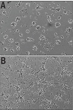 Recombinant Mouse IGSF4C/SynCAM4Fc Chimera (Catalog # 9906-S4) Induces Cortical Neurite Outgrowth.A) Untreated E16-18 embryonic rat cortical neurons. B) Neurite outgrowth inE16-18 embryonic rat cortical neurons treated with 0.5 μg/mL ofRecombinant Mouse IGSF4C/SynCAM4 Fc Chimera.