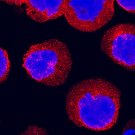 IKKe was detected in immersion fixed Ramos human Burkitt's lymphoma cell line using Goat Anti-Human IKKe Antigen Affinity-purified Polyclonal Antibody (Catalog # AF3199) at 15 µg/mL for 3 hours at room temperature. Cells were stained using the NorthernLights™ 557-conjugated Anti-Goat IgG Secondary Antibody (red; Catalog # NL001) and counterstained with DAPI (blue). Specific staining was localized to cytoplasm. View our protocol for Fluorescent ICC Staining of Non-adherent Cells.