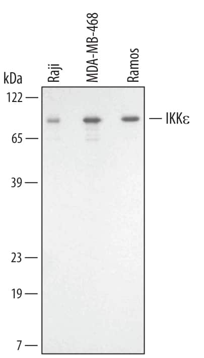 Western blot shows lysates of MDA-MB-468 human breast cancer cell line, Raji human Burkitt's lymphoma cell line, and Ramos human Burkitt's lymphoma cell line. PVDF membrane was probed with 1 µg/mL of Goat Anti-Human IKKe Antigen Affinity-purified Polyclonal Antibody (Catalog # AF3199) followed by HRP-conjugated Anti-Goat IgG Secondary Antibody (Catalog # HAF109). A specific band was detected for IKKe at approximately 80 kDa (as indicated). This experiment was conducted under reducing conditions and using Immunoblot Buffer Group 1.