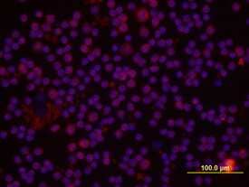 IL-10 was detected in immersion fixed porcine peripheral blood mononuclear cells (PBMCs) using 10 µg/mL Porcine IL-10 Antigen Affinity-purified Polyclonal Antibody (Catalog # AF693) for 3 hours at room temperature. Cells were stained with the NorthernLights™ 557-conjugated Anti-Goat IgG Secondary Antibody (red; Catalog # NL001) and counterstained with DAPI (blue). View our protocol for Fluorescent ICC Staining of Non-adherent Cells.