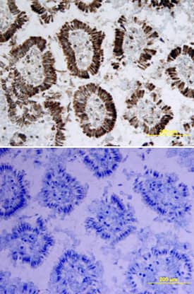 IL-15 was detected in perfusion fixed frozen sections of mouse intestine using Mouse IL-15 Biotinylated Antigen Affinity-purified Polyclonal Antibody (Catalog # BAF447) at 15 µg/mL overnight at 4 °C. Tissue was stained using the Anti-Goat HRP-DAB Cell & Tissue Staining Kit (brown; Catalog # CTS008) and counterstained with hematoxylin (blue). Lower panel shows a lack of labeling if primary antibodies are omitted and tissue is stained only with secondary antibody followed by incubation with detection reagents. View our protocol for Chromogenic IHC Staining of Frozen Tissue Sections.