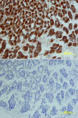 IL-15 was detected in perfusion fixed frozen sections of mouse intestine using Mouse IL-15 Biotinylated Antigen Affinity-purified Polyclonal Antibody (Catalog # BAF447) at 15 µg/mL overnight at 4 °C. Tissue was stained using the Anti-Goat HRP-DAB Cell & Tissue Staining Kit (brown; Catalog # CTS008) and counterstained with hematoxylin (blue). Lower panel shows a lack of labeling if primary antibodies are omitted and tissue is stained only with secondary antibody followed by incubation with detection reagents. View our protocol for Chromogenic IHC Staining of Frozen Tissue Sections.