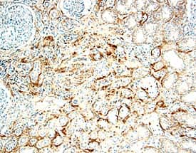 IL-17 RB was detected in immersion fixed paraffin-embedded sections of human kidney using 15 µg/mL Goat Anti-Human IL-17 RB Antigen Affinity-purified Polyclonal Antibody (Catalog # AF1207) overnight at 4 °C. Tissue was stained with the Anti-Goat HRP-DAB Cell & Tissue Staining Kit (brown; Catalog # CTS008) and counterstained with hematoxylin (blue). View our protocol for Chromogenic IHC Staining of Paraffin-embedded Tissue Sections.