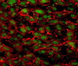 IL‑17 RD/SEF was detected in perfusion fixed frozen sections of mouse liver using 25 µg/mL Mouse IL‑17 RD/SEF Monoclonal Antibody (Catalog # MAB2276) overnight at 4 °C. Tissue was stained (red) and counterstained (green). View our protocol for Fluorescent IHC Staining of Frozen Tissue Sections.