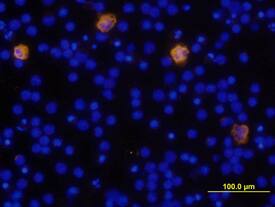 IL-1 beta /IL-1F2 was detected in immersion fixed human peripheral blood mononuclear cells (PBMCs) using Human IL-1 beta /IL-1F2 Biotinylated Antigen Affinity-purified Polyclonal Antibody (Catalog # BAF201) at 10 µg/mL for 3 hours at room temperature. Cells were stained using the NorthernLights™ 557-conjugated Anti-Goat IgG Secondary Antibody (yellow; Catalog # NL001) and counterstained with DAPI (blue). View our protocol for Fluorescent ICC Staining of Non-adherent Cells.