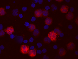 IL-1 beta /IL-1F2 was detected in immersion fixed human peripheral blood mononuclear cells (PBMCs) using Human IL-1 beta /IL-1F2 Biotinylated Antigen Affinity-purified Polyclonal Antibody (Catalog # BAF201) at 10 µg/mL for 3 hours at room temperature. Cells were stained using the NorthernLights™ 557-conjugated Streptavidin (red; Catalog # NL999) and counterstained with DAPI (blue). View our protocol for Fluorescent ICC Staining of Non-adherent Cells.