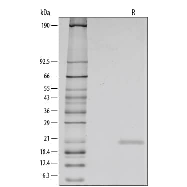 1 μg/lane of Recombinant Human IL-1ra/IL-1F3 was resolved with SDS-PAGE under reducing (R) conditions and visualized by silver staining, showing a single band at 20 kDa.