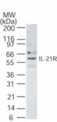 Western Blot: IL-21 R Antibody [NB100-56439] - Analysis of IL-21 R in 30 ug of Raji cell lysate using this antibody.