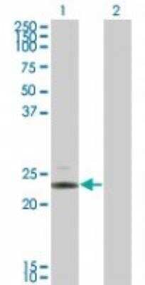 Western Blot: IL-24 Antibody [NBP2-23906] - Analysis of IL-24 in 1) transfected 293T cells and 2) untransfected 293T cells using this antibody.