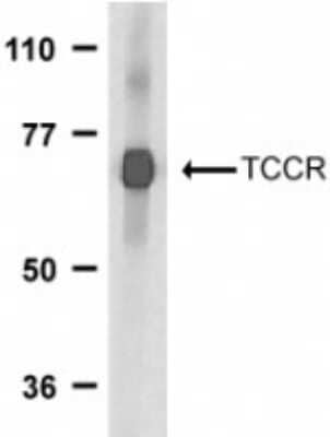 Western Blot: IL-27R alpha/WSX-1/TCCR Antibody [NBP1-76728] - Analysis of IL27RA expression in human spleen tissue lysates with anti-IL27RA using NBP1-76728 at 1 ug /ml.