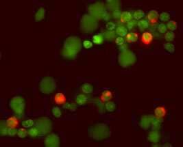 IL‑2 was detected in immersion fixed human peripheral blood mononuclear cells (PBMCs) stimulated with PMA and ionomycin using 15 µg/mL Goat Anti-Human/Primate IL‑2 Biotinylated Antigen Affinity-purified Polyclonal Antibody (Catalog # BAF202) for 3 hours at room temperature. Cells were stained (red) and counterstained (green). View our protocol for Fluorescent ICC Staining of Non-adherent Cells.