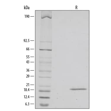 1 μg/lane of Recombinant Human IL-33 was resolved with SDS-PAGE under reducing (R) conditions and visualized by silver staining, showing a single band at 19 kDa.