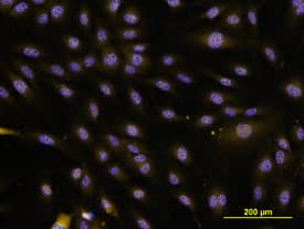 IL-33 was detected in immersion fixed HUVEC human umbilical vein endothelial cells using Goat Anti-Human IL-33 Propeptide Antigen Affinity-purified Polyclonal Antibody (Catalog # AF4810) at 10 µg/mL for 3 hours at room temperature. Cells were stained using the Northern-Lights™ 557-conjugated Anti-Goat IgG Secondary Antibody (yellow; Catalog # NL001) and counterstained with DAPI (blue). View our protocol for Fluorescent ICC Staining of Cells on Coverslips.