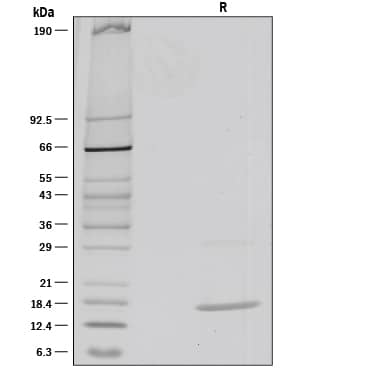 1 µg/lane of Recombinant Mouse IL‑36 beta /IL‑1F8 (aa 31-183) was resolved with SDS-PAGE under reducing (R) conditions and visualized by silver staining, showing a single band at 16 kDa.