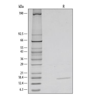 1 μg/lane of Recombinant Mouse IL-3 was resolved with SDS-PAGE under reducing (R) conditions and visualized by silver staining, showing a single band at 15 kDa.