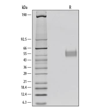 1 μg/lane of Recombinant Human IL-3 R alpha /CD123 was resolved with SDS-PAGE under reducing (R) conditions and visualized by silver staining, showing bands 55 kDa and 58 kDa.