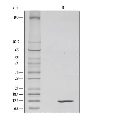 1 μg/lane of Recombinant Mouse IL-4 was resolved with SDS-PAGE under reducing (R) conditions and visualized by silver staining, showing a single band at 12 kDa.