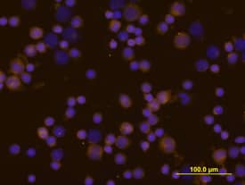 IL-4 was detected in immersion fixed equine peripheral blood mononuclear cells (PBMCs) using Goat Anti-Equine IL-4 Antigen Affinity-purified Polyclonal Antibody (Catalog # AF1809) at 10 µg/mL for 3 hours at room temperature. Cells were stained using the NorthernLights™ 557-conjugated Anti-Goat IgG Secondary Antibody (yellow; Catalog # NL001) and counterstained with DAPI (blue). View our protocol for Fluorescent ICC Staining of Non-adherent Cells.
