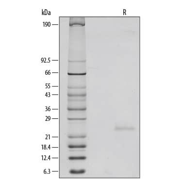 1 μg/lane of Recombinant Mouse IL-6 was resolved with SDS-PAGE under reducing (R) conditions and visualized by silver staining, showing a single band at 24 kDa.