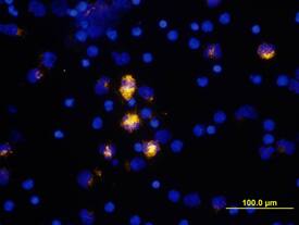 IL‑6 was detected in immersion fixed human peripheral blood mononuclear cells (PBMCs) stimulated with LPS and monensin using Mouse Anti-Human IL‑6 Monoclonal Antibody (Catalog # MAB2061) at 10 µg/mL for 3 hours at room temperature. Cells were stained using the NorthernLights™ 557-conjugated Anti-Mouse IgG Secondary Antibody (yellow; Catalog # NL007) and counterstained with DAPI (blue). View our protocol for Fluorescent ICC Staining of Non-adherent Cells.