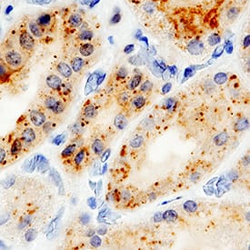     IL-15R  alpha was detected in immersion fixed paraffin-embedded sections of human  kidney using Mouse Anti-Human IL-15R alpha Monoclonal Antibody (Catalog #  MAB1472) at 5 µg/mL for 1 hour at room temperature  followed by incubation with the Anti-Mouse IgG VisUCyte™ HRP  Polymer Antibody (Catalog # VC001).  Before incubation with the primary antibody, tissue was subjected to  heat-induced epitope retrieval using Antigen Retrieval Reagent-Basic (Catalog  # CTS013).  Tissue was stained using DAB (brown) and counterstained with hematoxylin  (blue). Specific staining was localized to cytoplasm. View our protocol for  IHC  Staining with VisUCyte HRP Polymer Detection Reagents. 