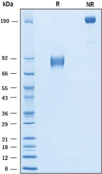 2 μg/lane of Recombinant Human IL1RAPL1 was resolved with SDS-PAGE under reducing (R) and non-reducing (NR) conditions and visualized by Coomassie® blue staining, showing bands at 81-92 kDa and 160-180 kDa, respectively.