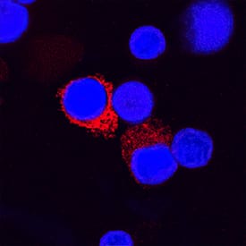 IL-1 beta /IL-1F2 was detected in immersion fixed human peripheral blood mononuclear cells using Goat Anti-Human IL-1 beta /IL-1F2 Polyclonal Antibody (Catalog # AB-201-NA) at 15 µg/mL for 3 hours at room temperature. Cells were stained using the NorthernLights™ 557-conjugated Anti-Goat IgG Secondary Antibody (red; Catalog # NL001) and counterstained with DAPI (blue). Specific staining was localized to cytoplasmic. View our protocol for Fluorescent ICC Staining of Non-adherent Cells.