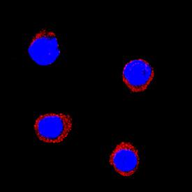 IL-1 beta /IL-1F2 was detected in immersion fixed equine peripheral blood mononuclear cells (PBMCs) using Goat Anti-Equine IL-1 beta /IL-1F2 Antigen Affinity-purified Polyclonal Antibody (Catalog # AF3340) at 25 µg/mL for 3 hours at room temperature. Cells were stained using the NorthernLights™ 557-conjugated Anti-Mouse IgG Secondary Antibody (red; Catalog # NL007) and counterstained with DAPI (blue). Specific staining was localized to cytoplasm. View our protocol for Fluorescent ICC Staining of Non-adherent Cells.