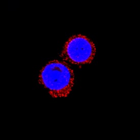 IL-1 beta /IL-1F2 was detected in immersion fixed equine peripheral blood mononuclear cells (PBMCs) using Mouse Anti-Equine IL-1 beta /IL-1F2 Monoclonal Antibody (Catalog # MAB33401) at 25 µg/mL for 3 hours at room temperature. Cells were stained using the NorthernLights™ 557-conjugated Anti-Mouse IgG Secondary Antibody (red; Catalog # NL007) and counterstained with DAPI (blue). Specific staining was localized to cytoplasm. View our protocol for Fluorescent ICC Staining of Non-adherent Cells.