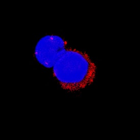 IL-1 beta /IL-1F2 was detected in immersion fixed mouse splenocytes treated with LPS using Recombinant Rat Anti-Mouse IL-1 beta /IL-1F2 Monoclonal Antibody (Catalog # MAB401R) at 25 µg/mL for 3 hours at room temperature. Cells were stained using the NorthernLights™ 557-conjugated Anti-Rat IgG Secondary Antibody (red; Catalog # NL013) and counterstained with DAPI (blue). Specific staining was localized to cytoplasm. View our protocol for Fluorescent ICC Staining of Non-adherent Cells.