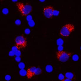 IL-1 beta /IL-1F2 was detected in immersion fixed human peripheral blood mononuclear cells (PBMCs) treated with 1 µg/mL LPS and 3 µM monensin for 24 hours using Mouse Anti-Human IL-1 beta /IL-1F2 Monoclonal Antibody (Catalog # MAB601R) at 10 µg/mL for 3 hours at room temperature. Cells were stained using the NorthernLights™ 557-conjugated Anti-Mouse IgG Secondary Antibody (red; Catalog # NL007) and counterstained with DAPI (blue). Specific staining was localized to cytoplasm. View our protocol for Fluorescent ICC Staining of Non-adherent Cells.