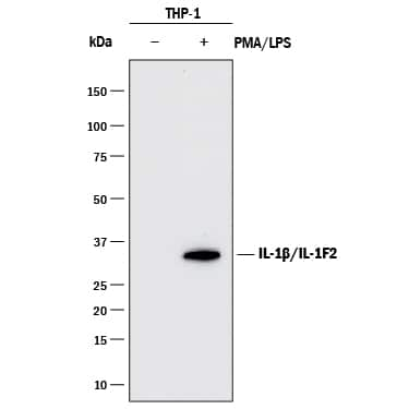 Western blot shows lysates of THP-1 human acute monocytic leukemia cell line untreated (-) or treated (+) with 200 nM PMA for 24 hours and 10 µg/mL LPS for 3 hours. PVDF membrane was probed with 1 µg/mL of Mouse Anti-Human IL-1 beta /IL-1F2 Monoclonal Antibody (Catalog # MAB601R) followed by HRP-conjugated Anti-Mouse IgG Secondary Antibody (Catalog # HAF018). A specific band was detected for IL-1 beta /IL-1F2 at approximately 35 kDa (as indicated). This experiment was conducted under reducing conditions and using Immunoblot Buffer Group 1.