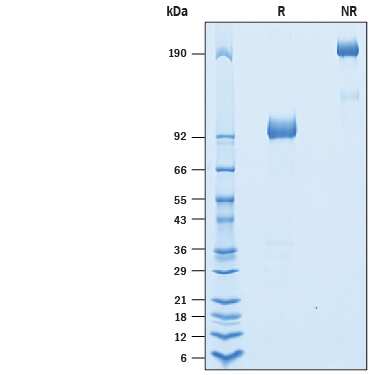 2 μg/lane of Recombinant Cynomolgus Monkey IL-23R Fc Chimera (Catalog # 10306-IR) was  resolved with SDS-PAGE under reducing (R) and non-reducing (NR)  conditions and visualized by Coomassie® Blue staining, showing bands at 91-102 kDa and 180-200 kDa, respectively.