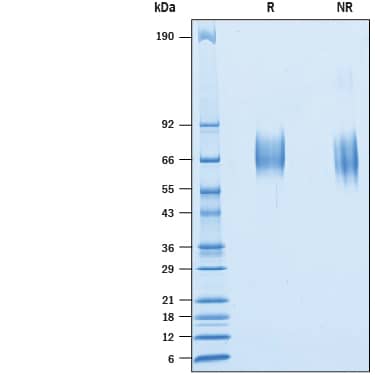 2 μg/lane of Recombinant Cynomolgus Monkey IL-23R His-tag (Catalog # 10331-IR) was  resolved with SDS-PAGE under reducing (R) and non-reducing (NR)  conditions and visualized by Coomassie® Blue staining, showing bands at 63-70 kDa.