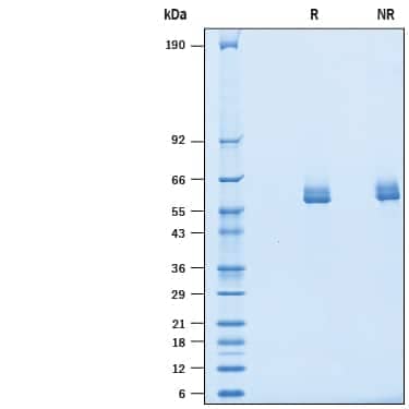 2 μg/lane of Recombinant Cynomolgus Monkey IL-27 His-tag (Catalog # 10307-IL) was  resolved with SDS-PAGE under reducing (R) and non-reducing (NR)  conditions and visualized by Coomassie® Blue staining, showing bands at 54-65 kDa.