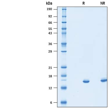 2 μg/lane of Recombinant Human IL-2 (Mammalian-expressed) Protein (Catalog # 10453-IL) was resolved withSDS-PAGE under reducing (R) and non-reducing (NR) conditions and visualized byCoomassie® Blue staining, showing bands at kDa.