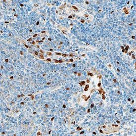 IL‑33 was detected in immersion fixed paraffin-embedded sections of human tonsil using Rabbit Anti-Human IL‑33 Monoclonal Antibody (Catalog # MAB36252) at 15 µg/mL overnight at 4 °C. Tissue was stained using the Anti-Rabbit HRP-DAB Cell & Tissue Staining Kit  (brown; Catalog # CTS005) and counterstained with hematoxylin (blue). Specific staining was localized to nuclei in high endothelial venules. View our protocol for Chromogenic IHC Staining of Paraffin-embedded Tissue Sections. 