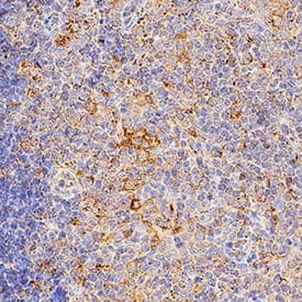 IL-6 was detected in perfusion fixed frozen sections of mouse thymus using Goat Anti-Mouse IL-6 Biotinylated Antigen Affinity-purified Polyclonal Antibody (Catalog # BAF406) at 1 µg/mL overnight at 4 °C. Tissue was stained using the Anti-Mouse HRP-AEC Cell & Tissue Staining Kit (brown; Catalog # CTS003) and counterstained with hematoxylin (blue). Specific staining was localized to cell surfaces in lymphocytes. View our protocol for Chromogenic IHC Staining of Frozen Tissue Sections.
