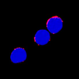 IL-6R alpha was detected in immersion fixed human peripheral blood mononuclear cells (PBMCs) using Recombinant Mouse Anti-Human IL-6R alpha Monoclonal Antibody (Catalog # MAB2271R) at 3 µg/mL for 3 hours at room temperature. Cells were stained using the NorthernLights™ 557-conjugated Anti-Mouse IgG Secondary Antibody (red; Catalog # NL007) and counterstained with DAPI (blue). Specific staining was localized to cytoplasm. View our protocol for Fluorescent ICC Staining of Non-adherent Cells.
