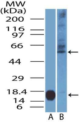 Western Blot: IL7 Receptor alpha Antibody [NBP2-29618] - WB analysis of IL7 Receptor alpha/CD127 protein on (A) partial recombinant protein IL7 Receptor alpha (primary antibody conc. 0.5 ug/ml) and on (B) human spleen lysate (primary antibody conc. 4.0 ug/ml). In spleen lysate, this antibody detected a distinct IL7 Receptor alpha band at its predicted size (~50-55 kDa) along with some diffused bands at higher molecular weight position (potentially the glycosylated form of this protein). 