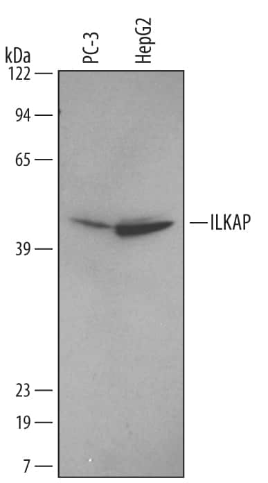 Western Blot ILKAP/PP2C delta Antibody (499526)