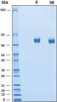 2 μg/lane of Recombinant Mouse IL-Y was resolved with SDS-PAGE underreducing (R) and non-reducing (NR) conditions and visualized by Coomassie® Bluestaining, showing bands at 74‑84 kDa.