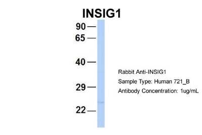 Western Blot: INSIG-2 Antibody [NBP1-59687] - Sample Type: 721_B Antibody Dilution: 1.0 ug/ml INSIG2 is supported by BioGPS gene expression data to be expressed in 721_B