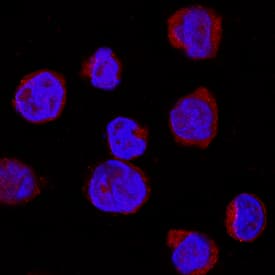 IRAK4 was detected in immersion fixed U937 human histiocytic lymphoma cell line using Rat Anti-Human IRAK4 Monoclonal Antibody (Catalog # MAB39191) at 8 µg/mL for 3 hours at room temperature. Cells were stained using the NorthernLights™ 557-conjugated Anti-Rat IgG Secondary Antibody (red; Catalog # NL013) and counterstained with DAPI (blue). Specific staining was localized to cell surface. View our protocol for Fluorescent ICC Staining of Cells on Coverslips.