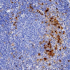 IRAK4 was detected in immersion fixed paraffin-embedded sections of human tonsil using Rat Anti-Human IRAK4 Monoclonal Antibody (Catalog # MAB3919) at 5 µg/mL overnight at 4 °C. Before incubation with the primary antibody, tissue was subjected to heat-induced epitope retrieval using Antigen Retrieval Reagent-Basic (Catalog # CTS013). Tissue was stained using the Anti-Rat HRP-DAB Cell & Tissue Staining Kit (brown; Catalog # CTS017) and counterstained with hematoxylin (blue). Specific staining was localized to cytoplasm in lymphocytes. View our protocol for Chromogenic IHC Staining of Paraffin-embedded Tissue Sections.