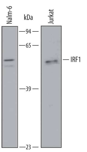 Western blot shows lysates of Nalm-6 human Pre-B acute lymphocytic leukemia cell line and Jurkat human acute T cell leukemia cell line. PVDF Membrane was probed with 1 µg/mL of Human IRF1 Antigen Affinity-purified Polyclonal Antibody (Catalog # AF4830) followed by HRP-conjugated Anti-Goat IgG Secondary Antibody (Catalog # HAF019). A specific band was detected for IRF1 at approximately 48 kDa (as indicated). This experiment was conducted under reducing conditions and using Immunoblot Buffer Group 9.