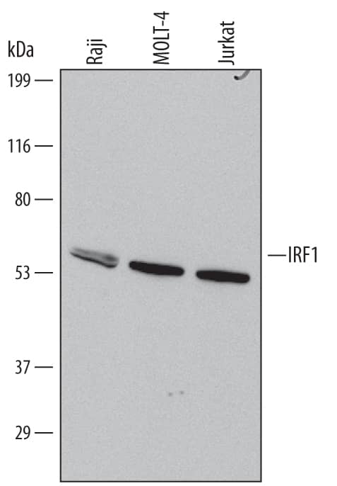 Western blot shows lysates of Raji human Burkitt's lymphoma cell line, MOLT-4 human acute lymphoblastic leukemia cell line, and Jurkat human acute T cell leukemia cell line. PVDF Membrane was probed with 0.5 µg/mL of Human IRF1 Monoclonal Antibody (Catalog # MAB4830) followed by HRP-conjugated Anti-Mouse IgG Secondary Antibody (Catalog # HAF007). A specific band was detected for IRF1 at approximately 50 kDa (as indicated). This experiment was conducted under reducing conditions and using Immunoblot Buffer Group 1.