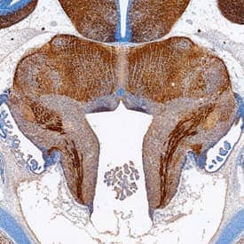 ISLR-2 was detected in immersion fixed frozen sections of embryonic mouse brainstem (13 d.p.c.) using Sheep Anti-Mouse ISLR-2 Antigen Affinity-purified Polyclonal Antibody (Catalog # AF4650) at 1.7 µg/mL overnight at 4 °C. Tissue was stained using the Anti-Sheep HRP-DAB Cell & Tissue Staining Kit (brown; Catalog # CTS019) and counterstained with hematoxylin (blue). Specific staining was localized to neuronal processes. View our protocol for Chromogenic IHC Staining of Frozen Tissue Sections.