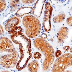 SKG was detected in paraffin-embedded sections of human kidney using Rabbit Anti-Human SGK Antigen Affinity-purified Polyclonal Antibody (Catalog # AF3200) at 3 μg/mL for 1 hour at room temperature followed byincubation for 30 minutes at room temperature with Anti-Rabbit IgG VisUCyte HRP Polymer Antibody (Catalog # VC003). Tissue was stained with DAB (brown color) andcounterstained with hematoxylin (blue color).